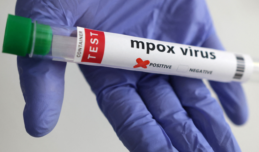 France identifies first case of new mpox variant, AFP reports - GHealth ...